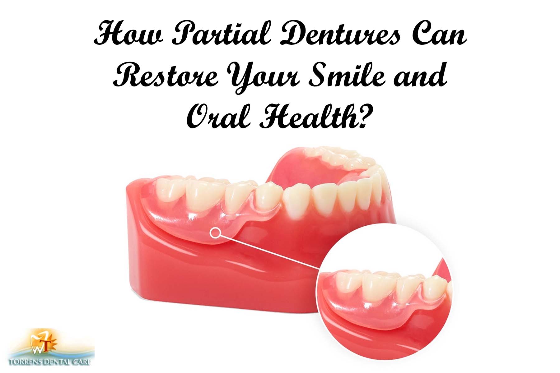 How Partial Dentures Can Restore Your Smile and Oral Health?